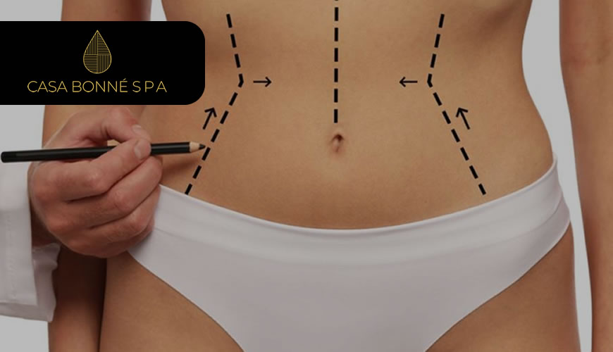 Masaje reductivo de drenaje linfático o liposucción con cirugía. ¿Qué es mejor para ti?