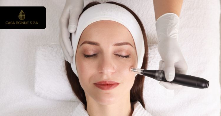Microneedling en Guadalajara | Estimula Colágeno Natural | Casa Bonné Spa