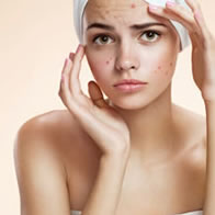 Tratamiento para piel con acné